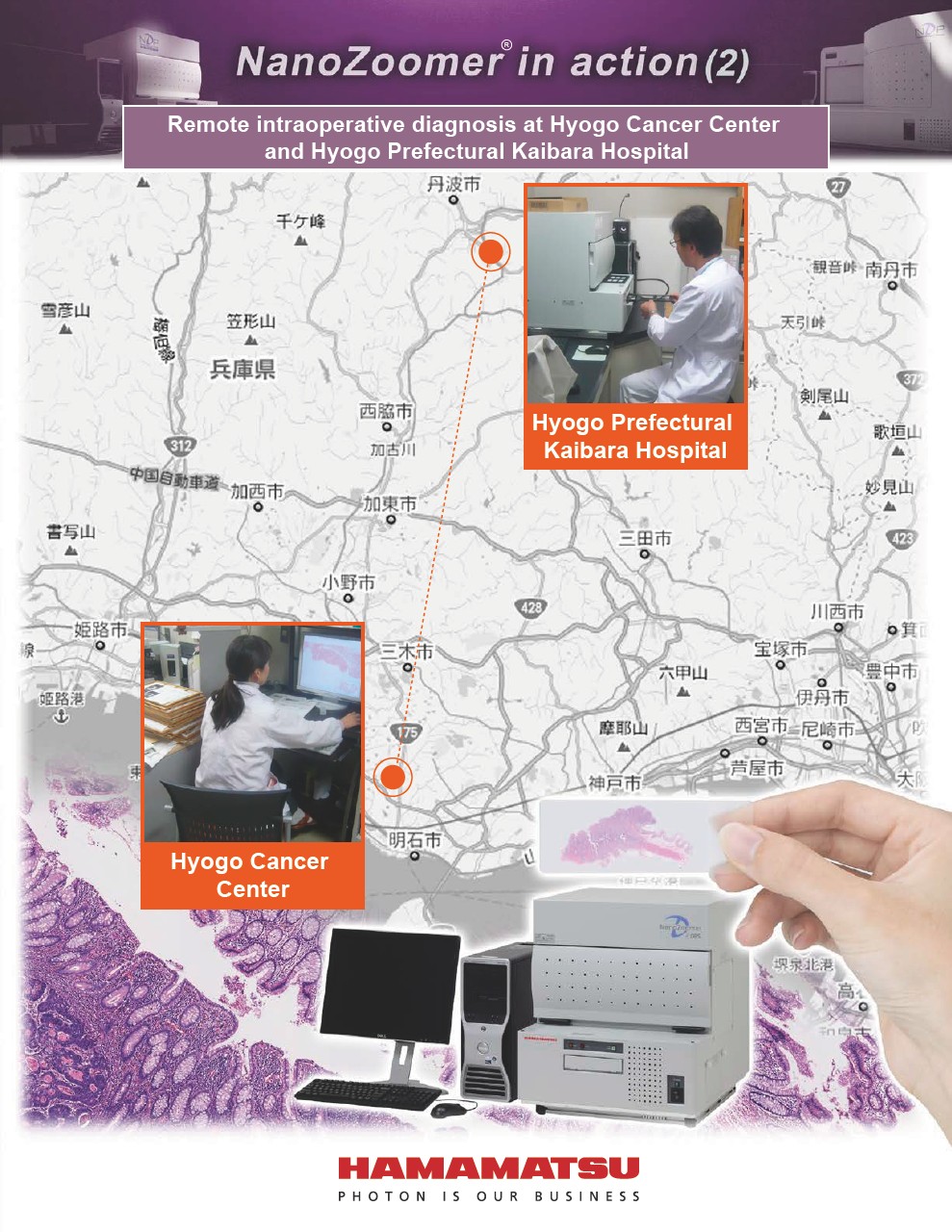 NanoZoomer in action (2) Remote intraoperative diagnosis at Hyogo Cancer Center and Hyogo Prefectural Kaibara Hospital