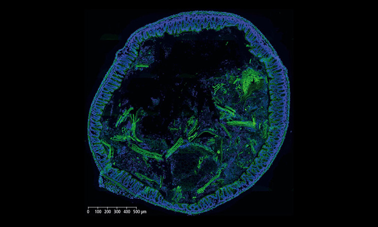 NanoZoomer Casestudy bioaster