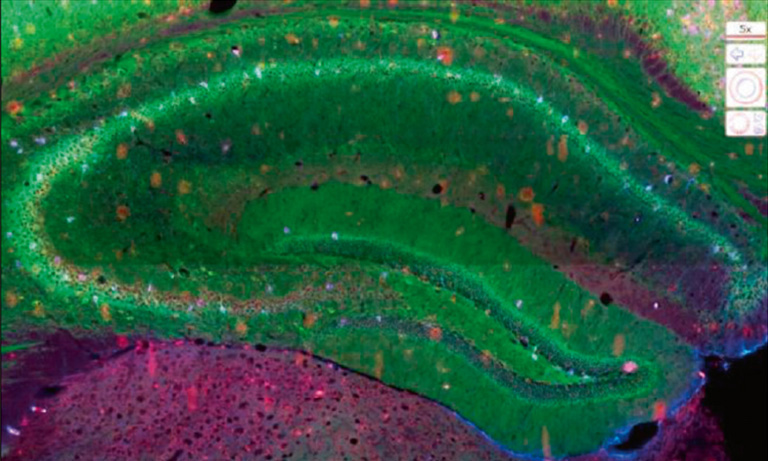 NanoZoomer Casestudy unveiling the cellular distribution