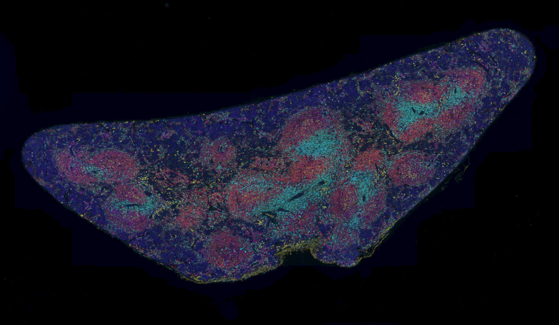 Mouse spleen with multiplex staining