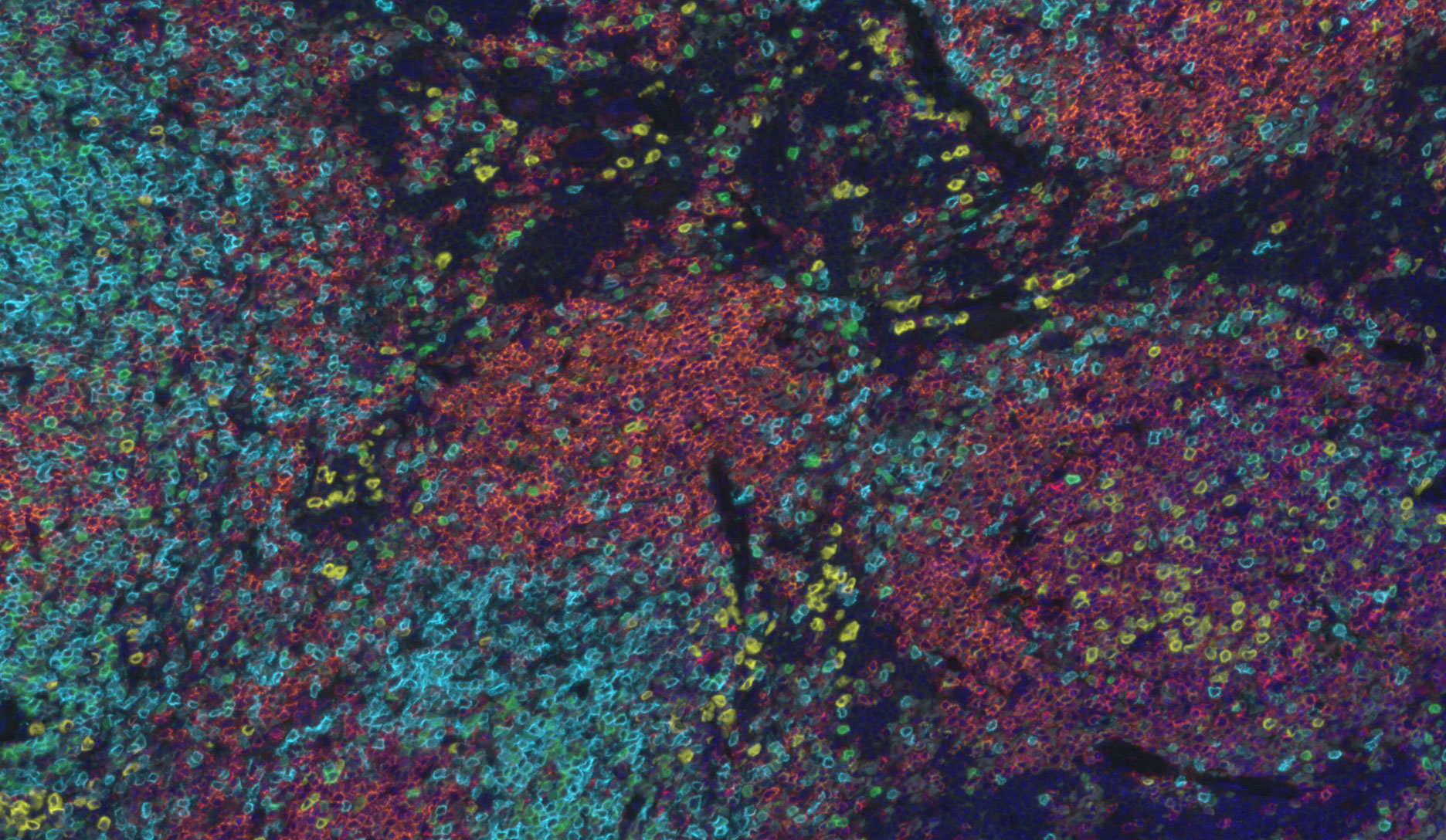 Mouse spleen with multiplex staining (40x magnification)