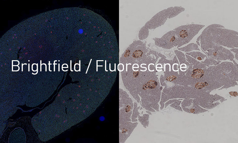 NanoZoomer bright field / fluorescence