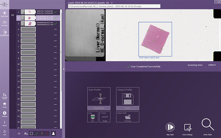 Semi automatic scanning