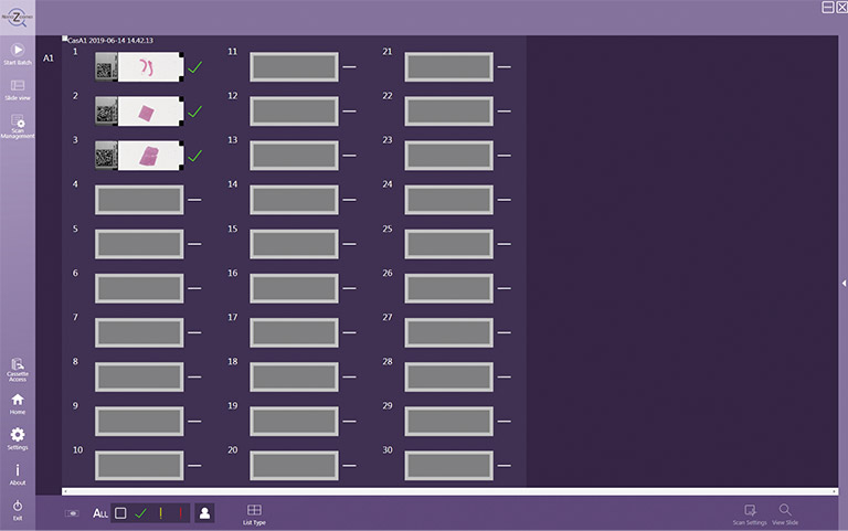 Fully automatic scanning