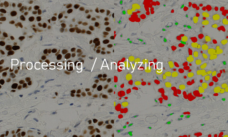 NanoZoomer processing/analyzing
