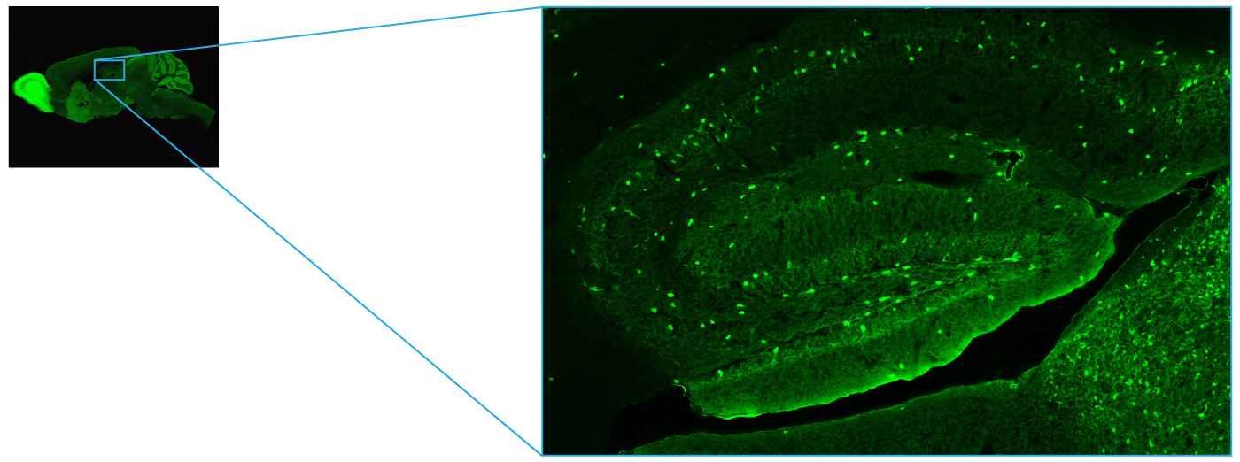 Green fluorescent protein (EGFP) expressed mouse brain tissue slice