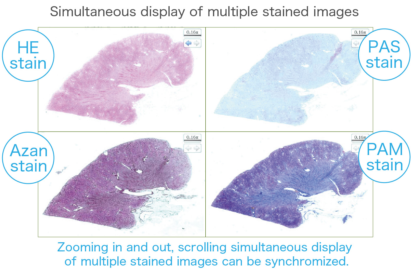 NanoZoomer view feature