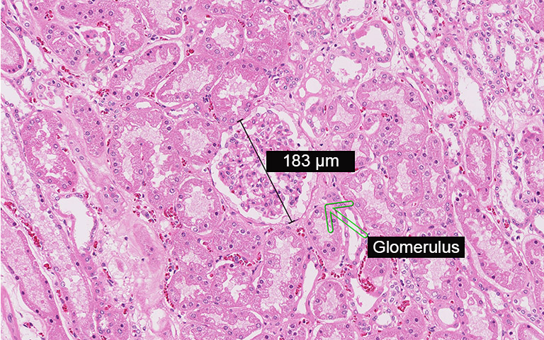 NanoZoomer view feature