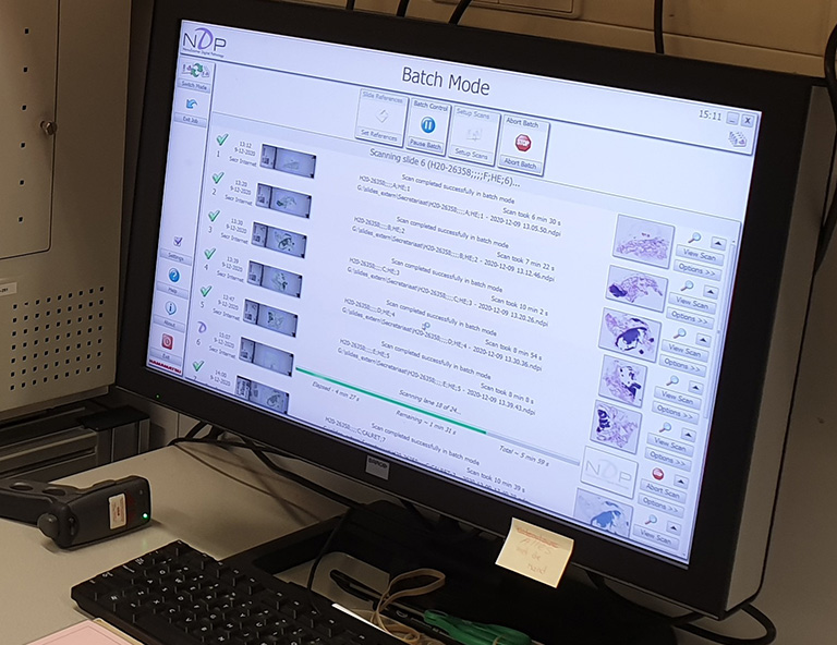 NanoZoomer Casestudy Erasmus MC 06