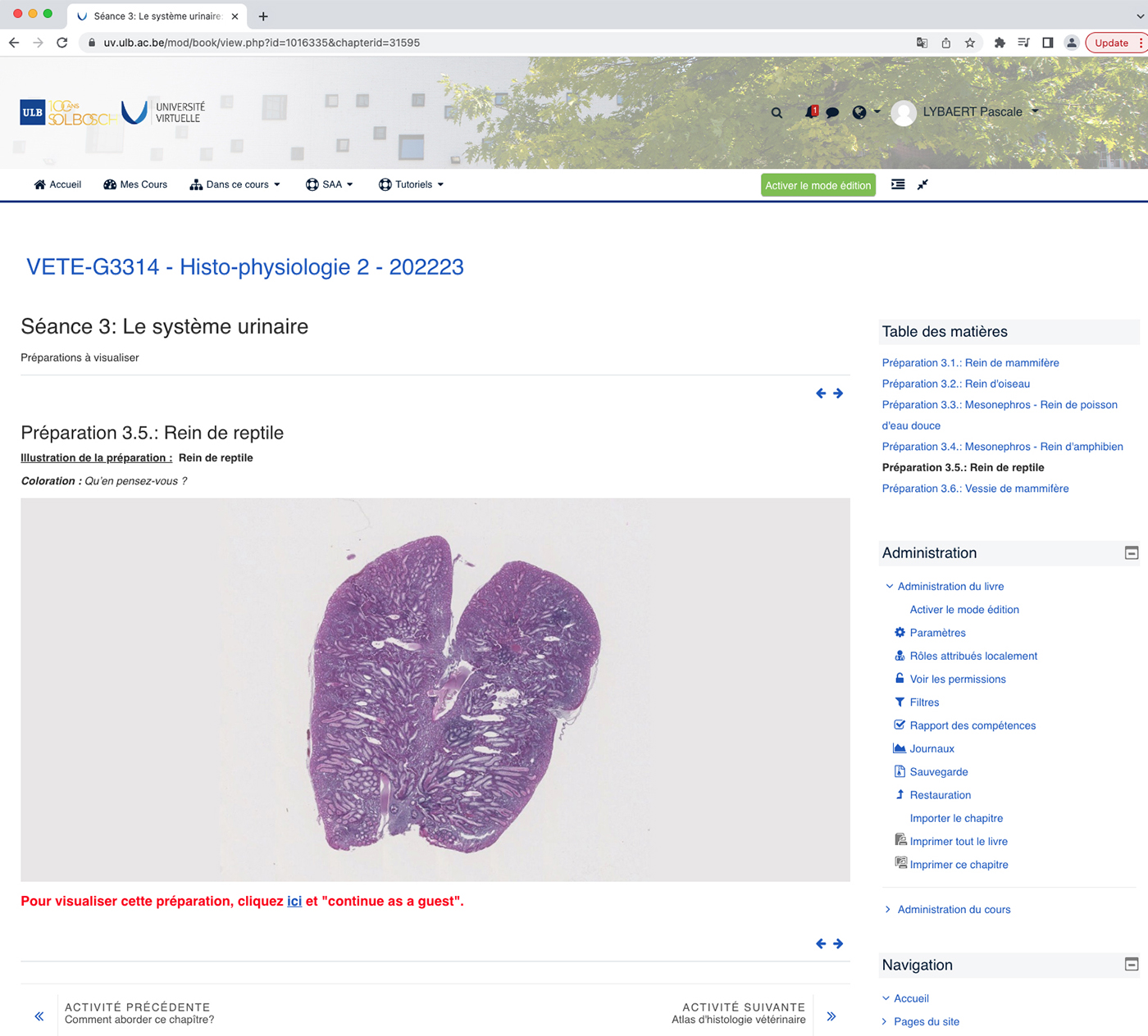 NanoZoomer Casestudy ULB03