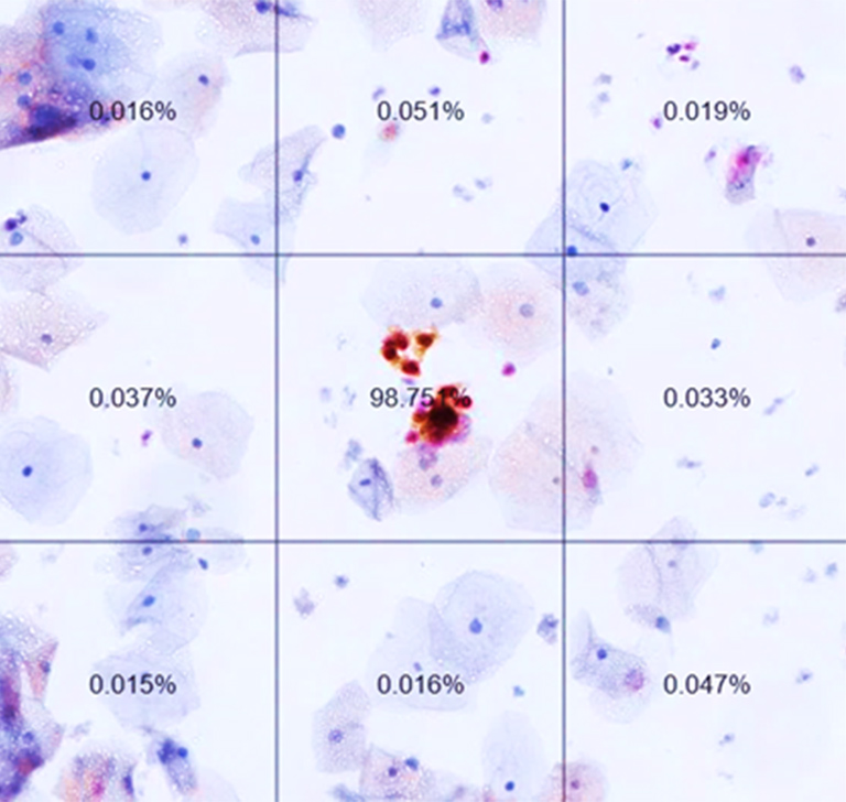 NanoZoomer Casestudy cytoreader 04