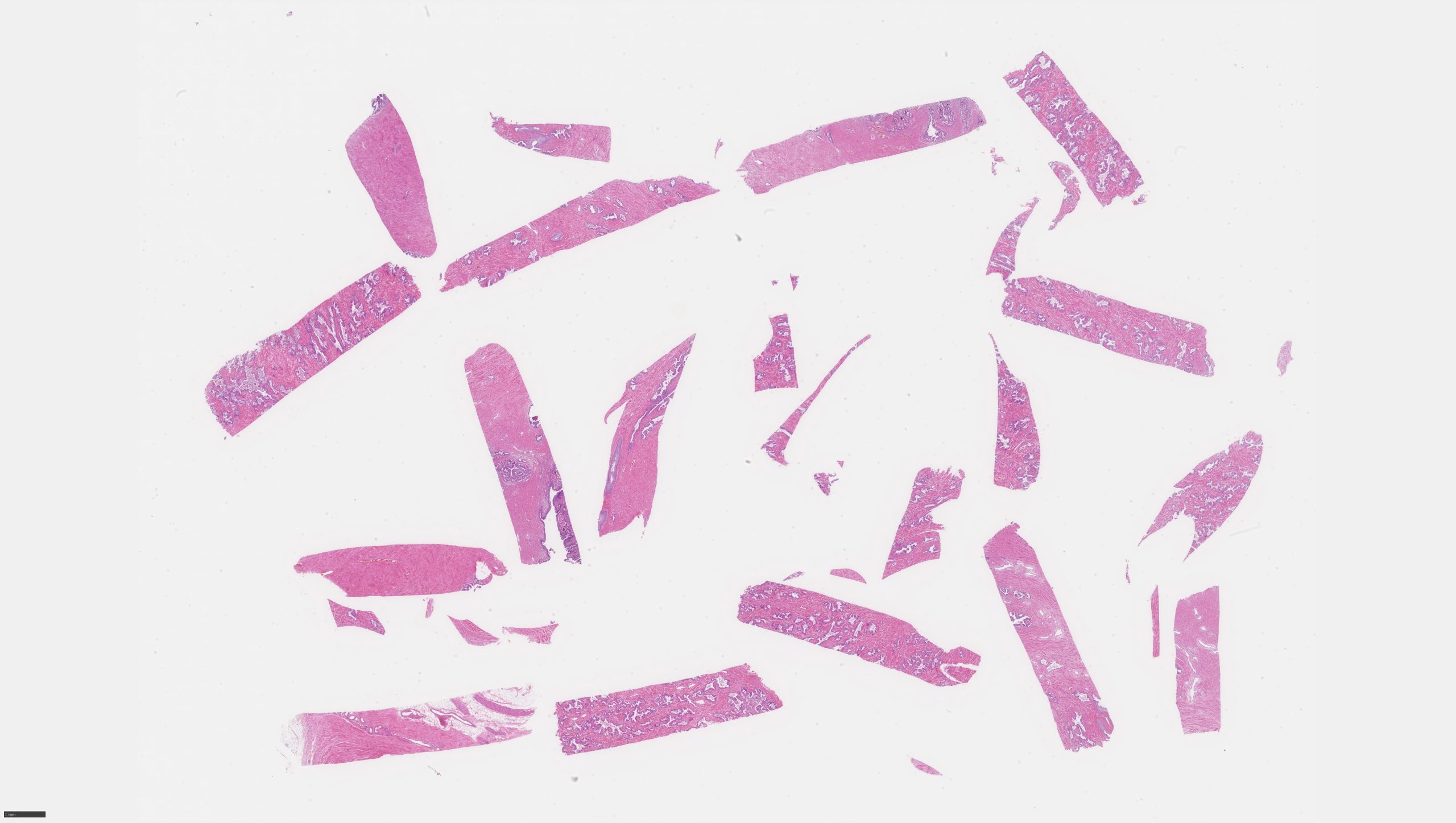 image of Prostate_HE