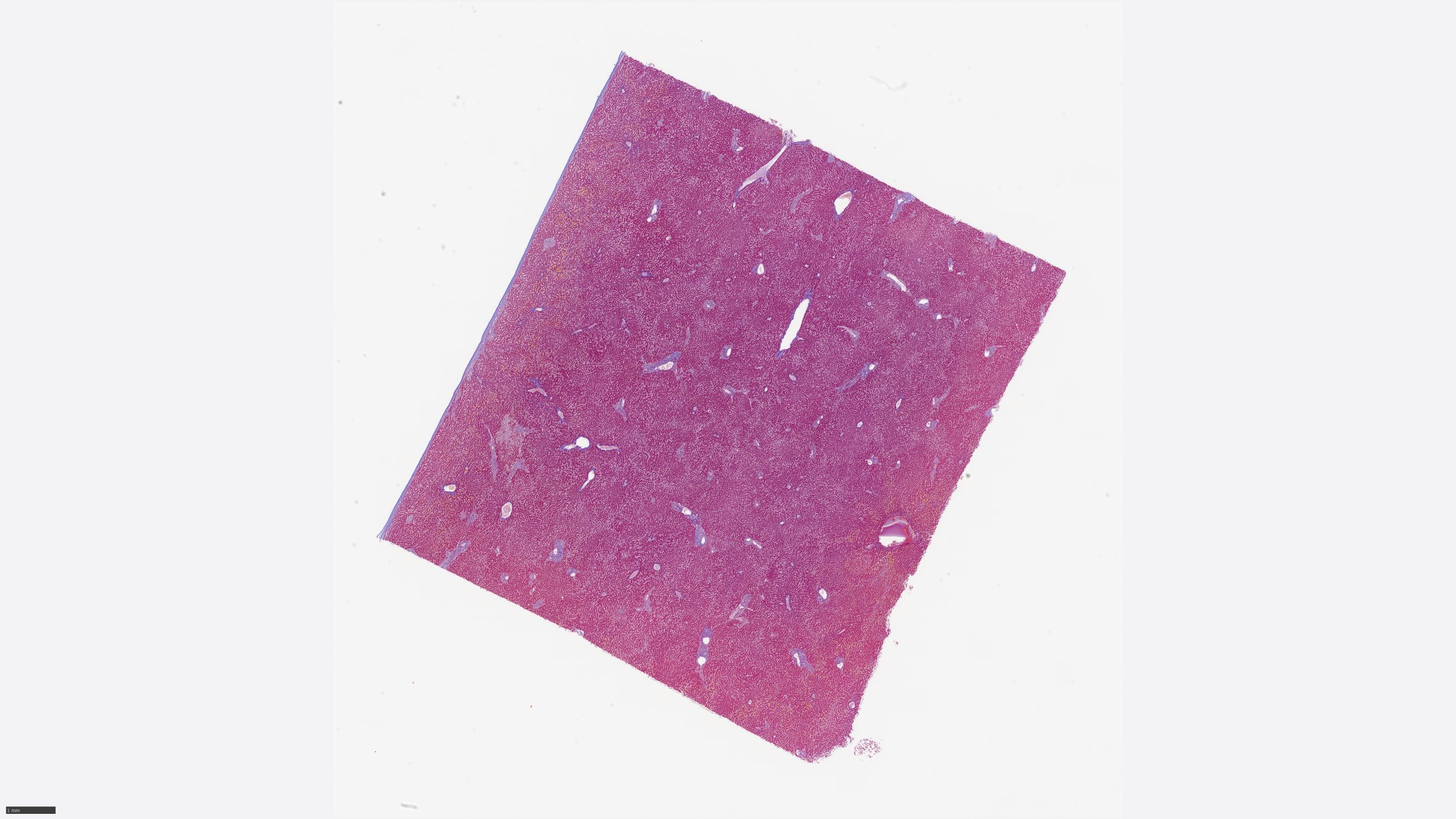image of Liver_Azan