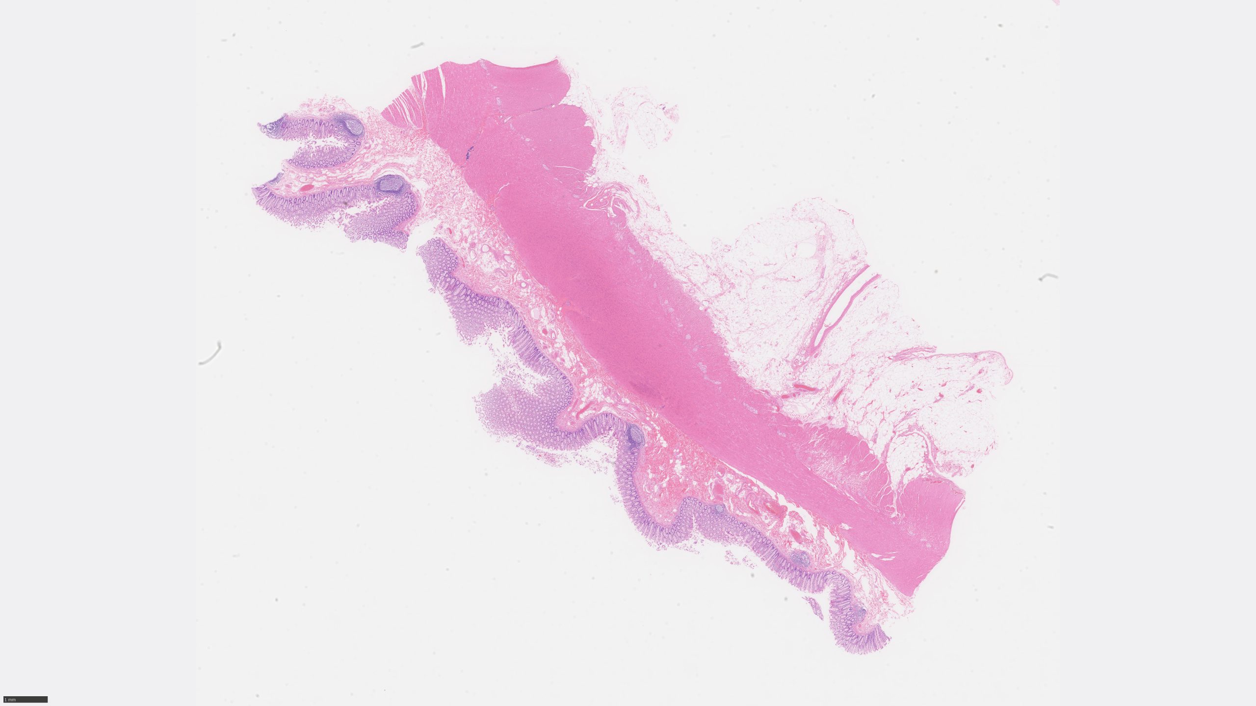 image of Colon_HE