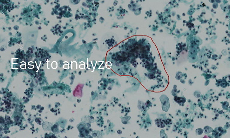 NanoZoomer routine easy to analyze